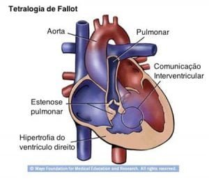 centro-de-cardiopatias-congenitas