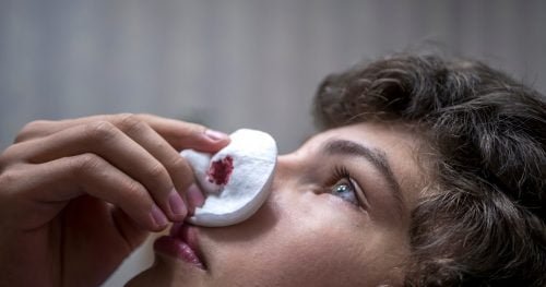 O que fazer quando o nariz de uma criança começa a sangrar?